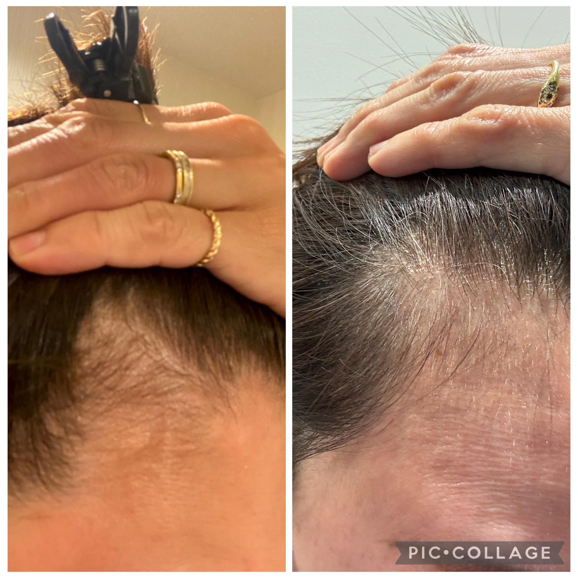 Before & After