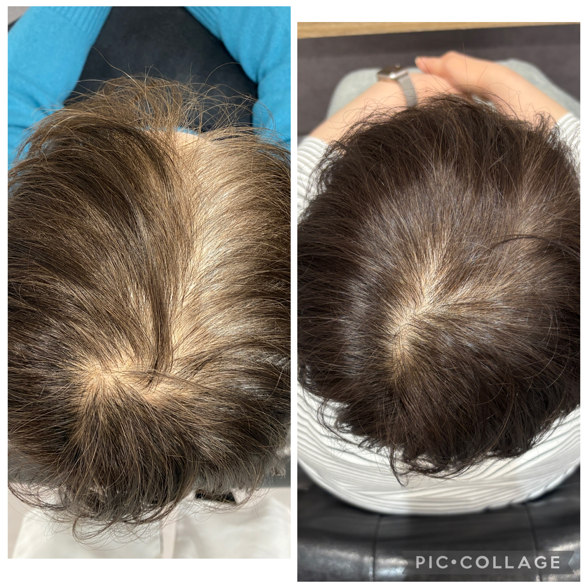 Before & After