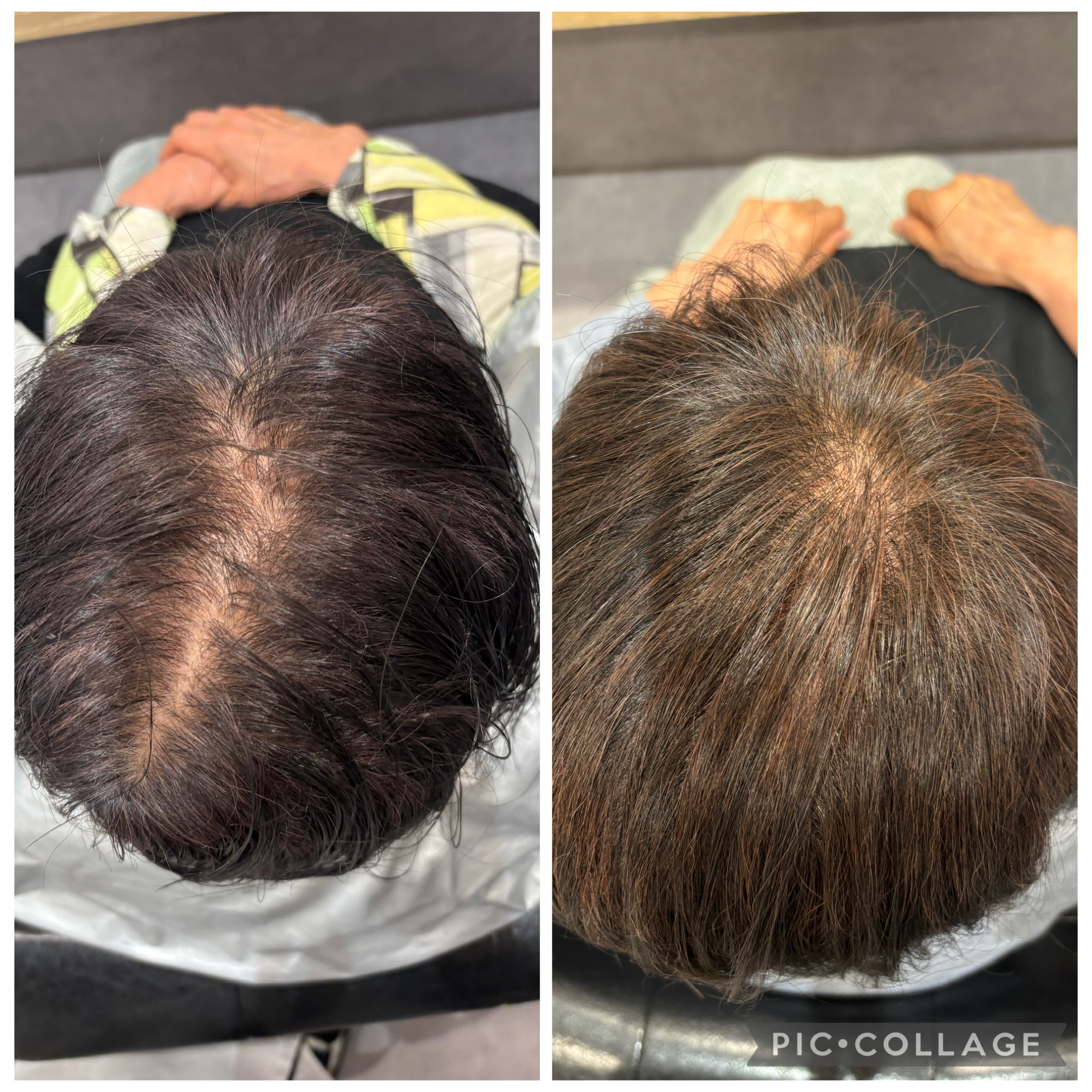 Before & After